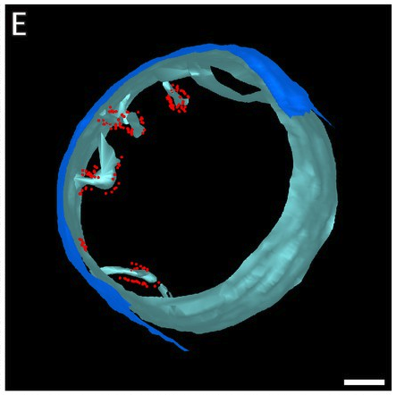 Molecular and topological reorganizations in mitochondrial architecture interplay during Bax-mediated steps of apoptosis