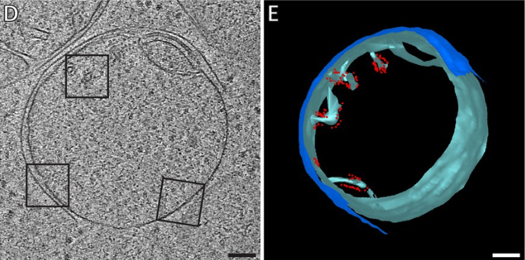 Electron Cryo-Tomography (cryo-ET)